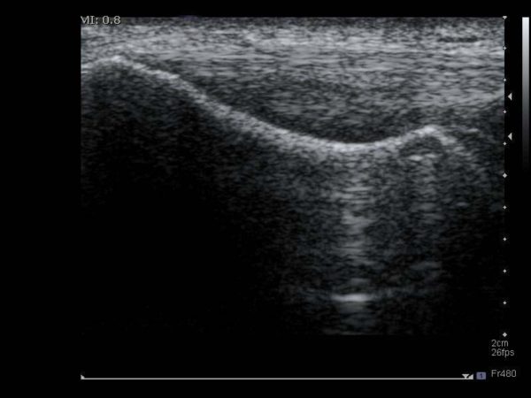General Imaging - Logiq