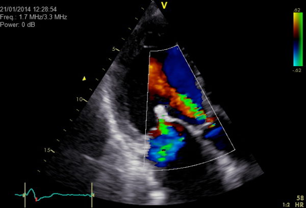 Cardiovascular - Vivid Family